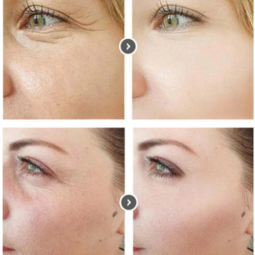 Curenex - Salmon DNA  Repair Serum